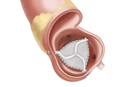 Artificial heart valve testing introduction