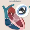 ISO 5840 Heart valve prostheses testing methods