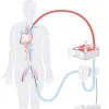 ISO 12417-1 Test Methods for Cardiovascular implants and extracorporeal systems