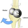 ASTM F2722 Test of Mobile Bearing Knee Tibial Baseplate Rotational Stops