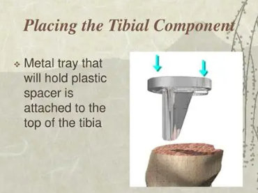ASTM F1800 Knee Tibial tray Fatigue testing