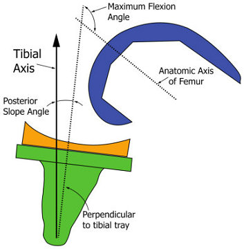 ASTM F2777 knee bearing (tibial insert) endurance fatigue test and deformation under high flexion